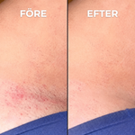 Växtbaserat Hårväxtreducerande Serum