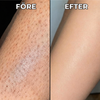 Växtbaserat Hårväxtreducerande Serum